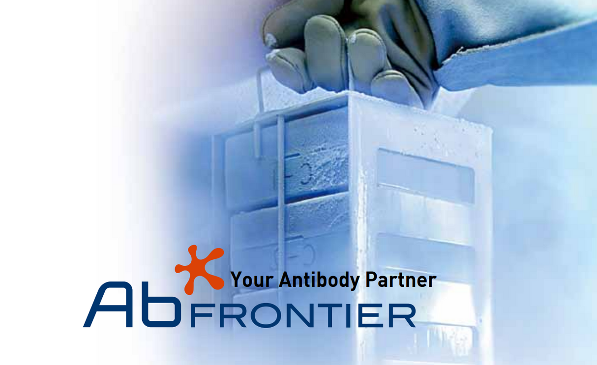 Human CFTR (Cystic Fibrosis Transmembrane Conductance Regulator) ELISA Kit - 96 wells plate